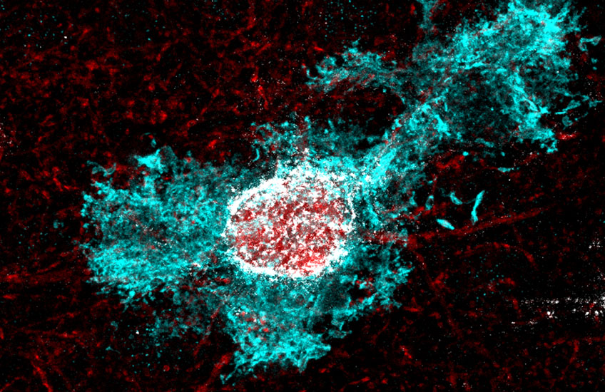 Research Reveals Link Between Stress Hormone, Brain Plasticity in